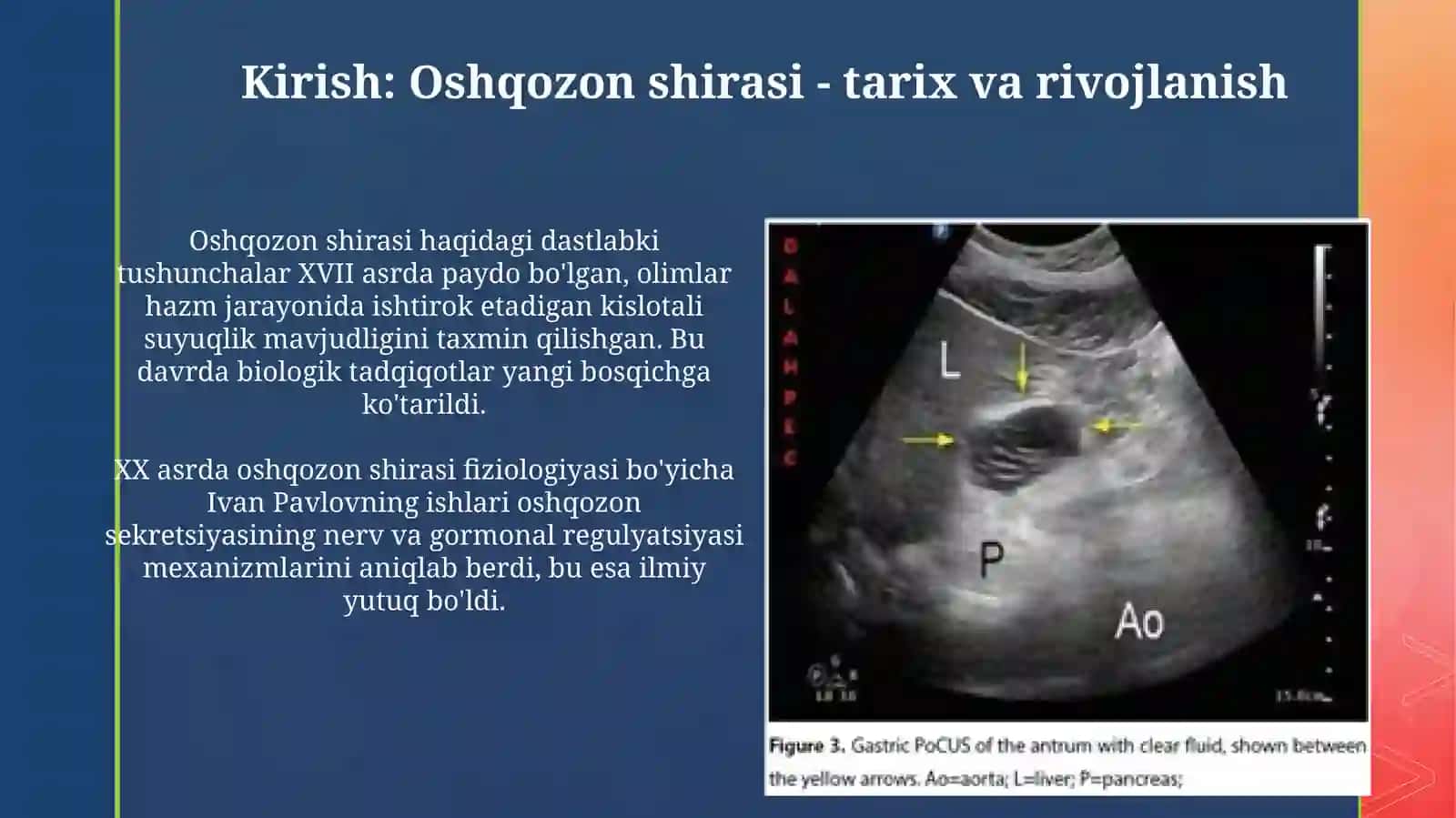 Oshqozon shirasini interpritatsiyasi 3