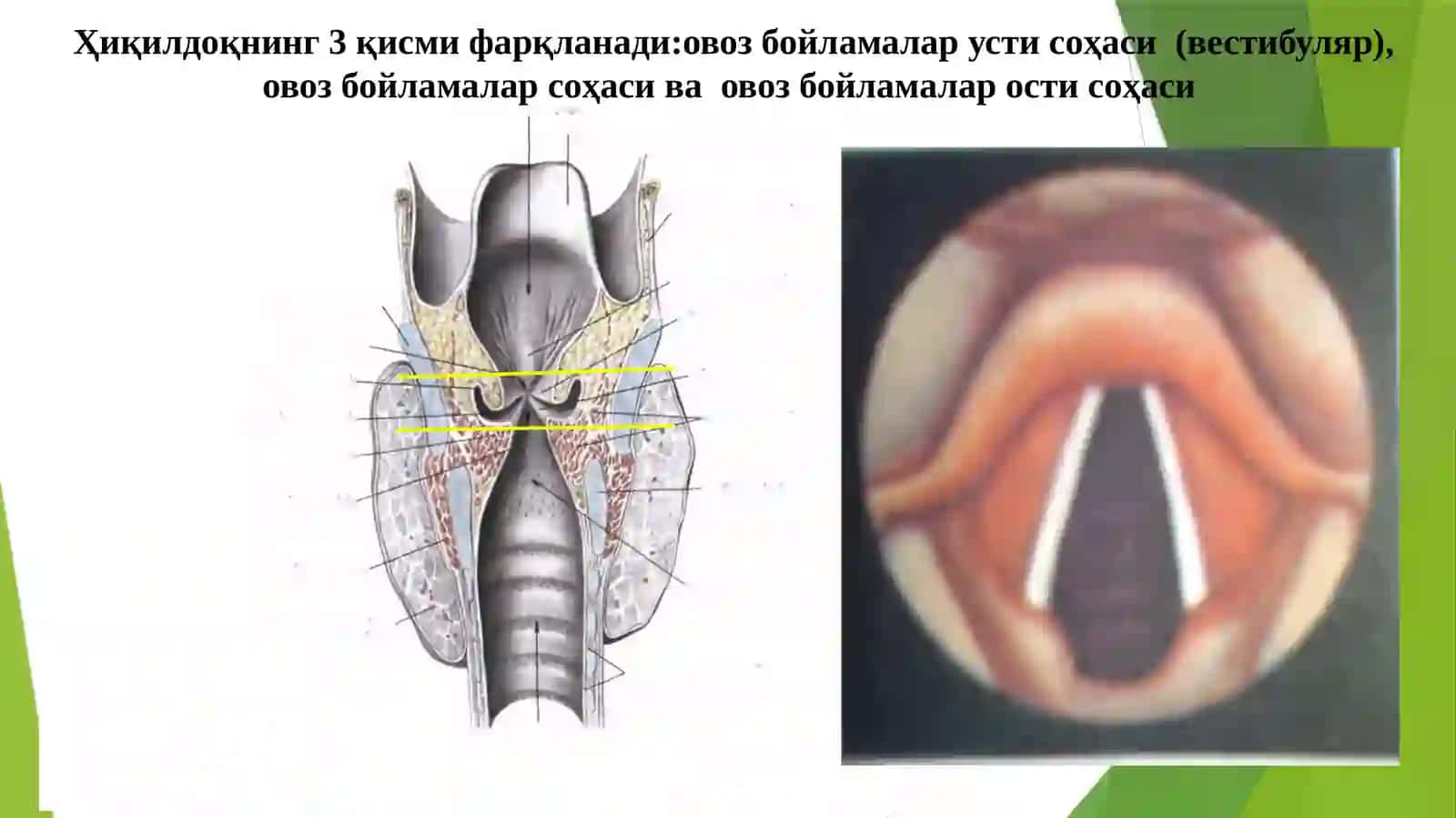 Ҳиқилдоқраки-С32 3