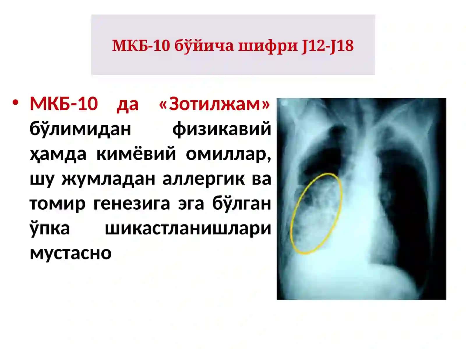БОЛАЛАРДА КАСАЛХОНАДАН ТАШҚАРИ ЗОТИЛЖАМ 3