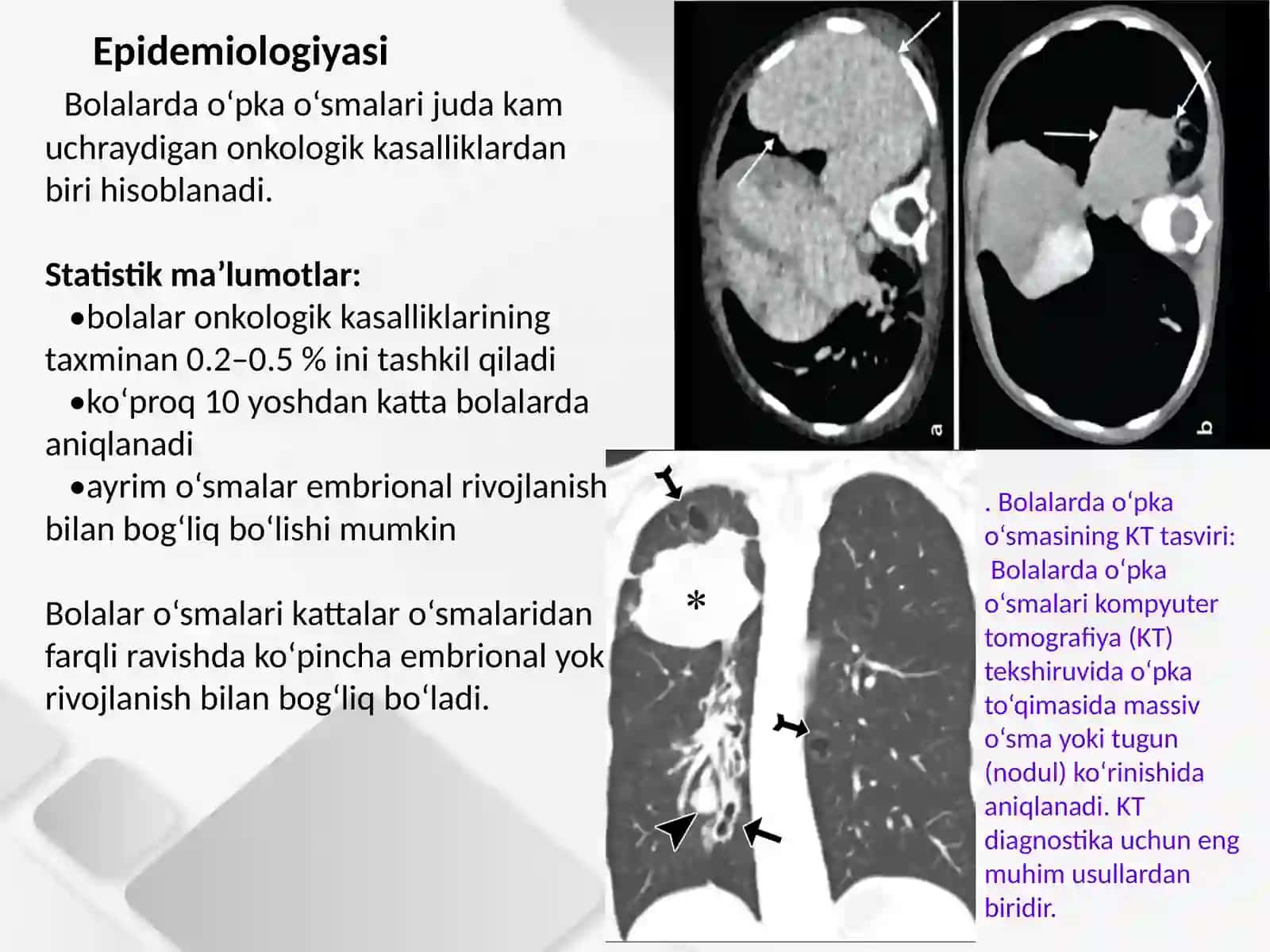 Bolalarda oʻpka oʻsma kasaliklari 3