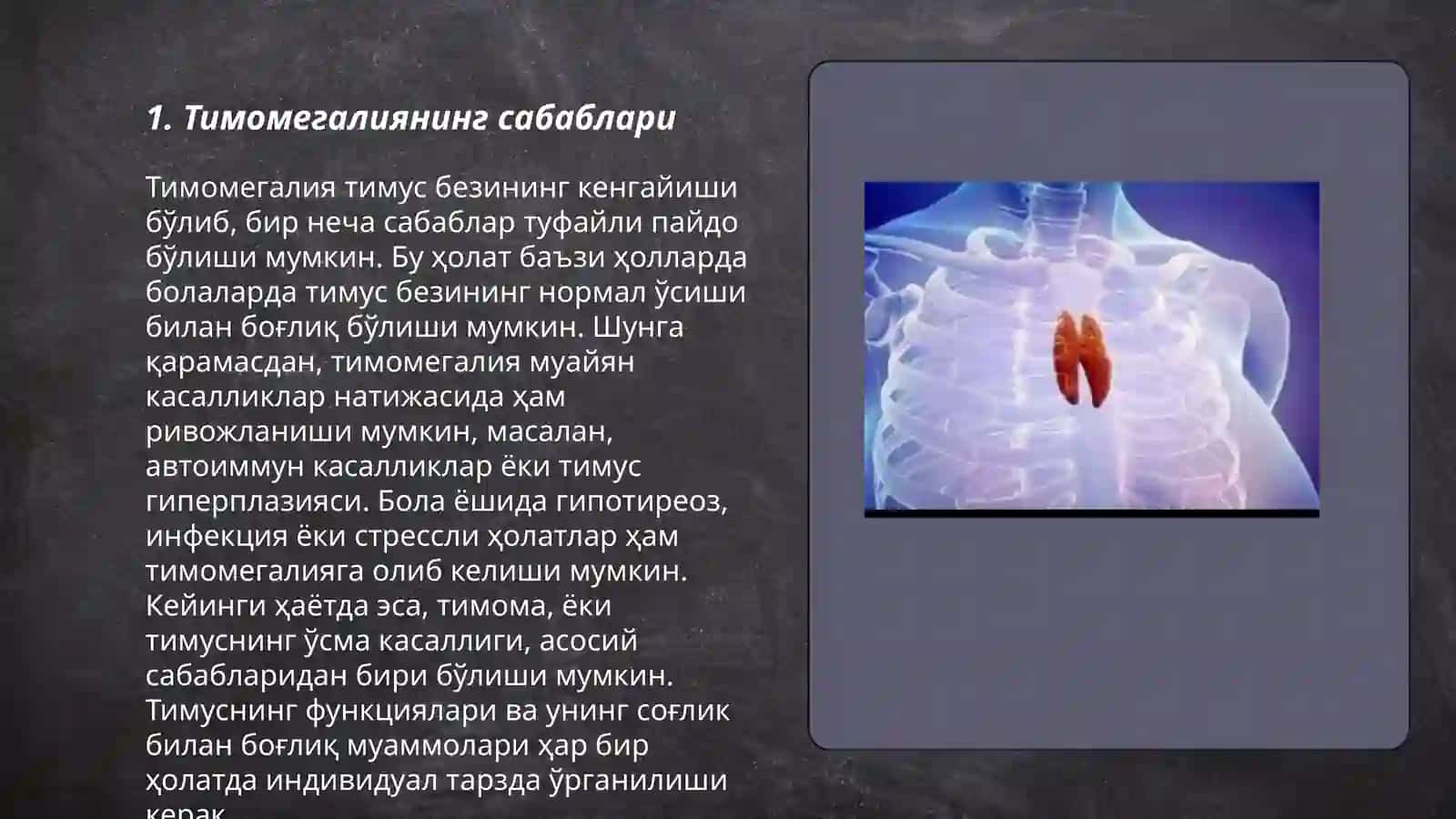 Тимомегалия 3