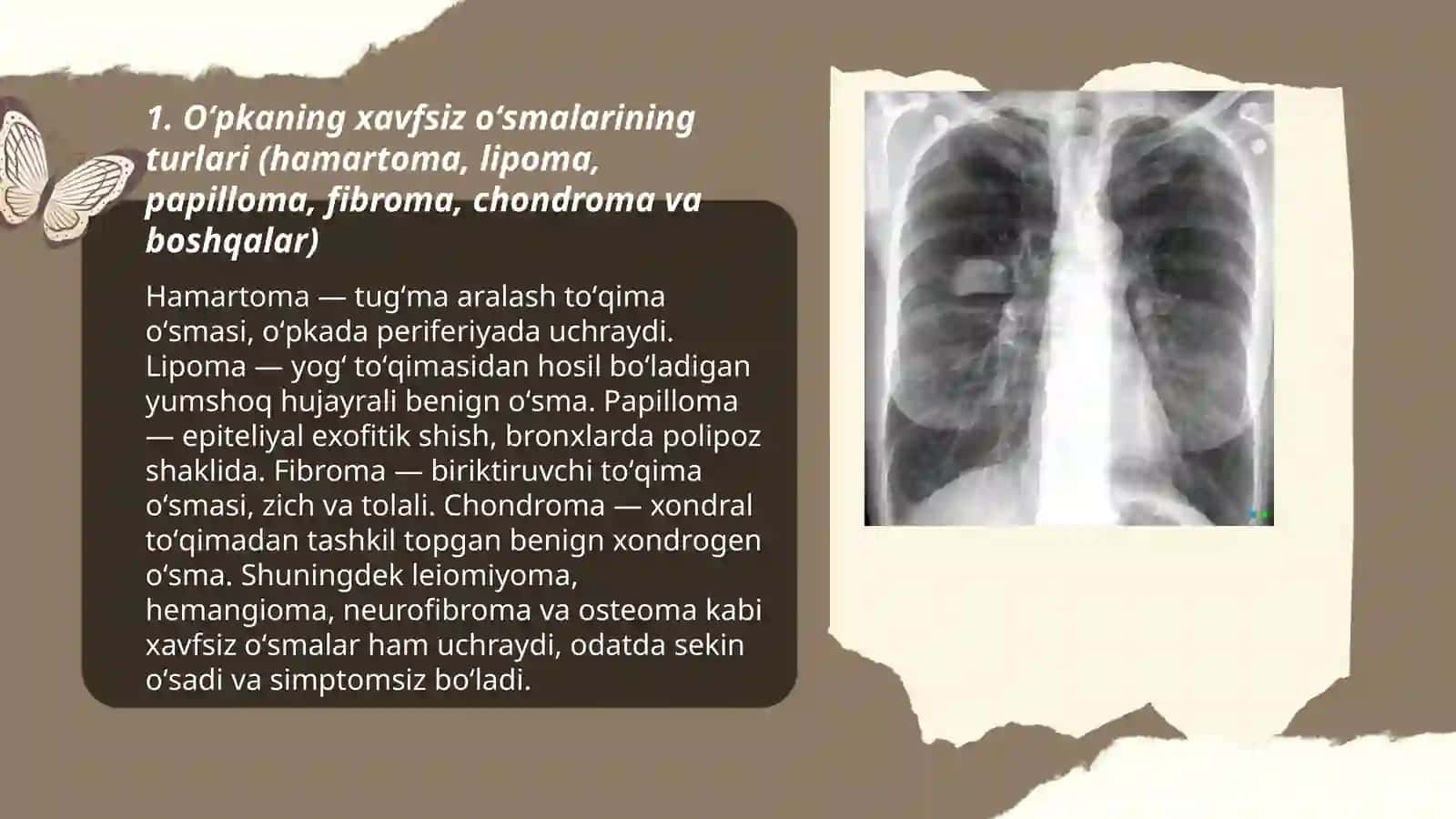 Oʻpkaning xavfsiz oʻsmalari 3