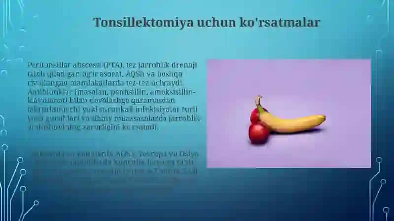 Tonsillektomiya uchun ko'rsatmalar 3