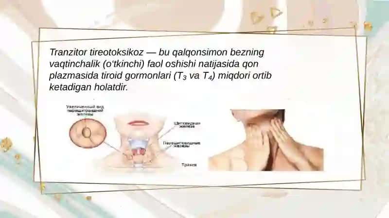 Tranzitor trieotoksikoz 3