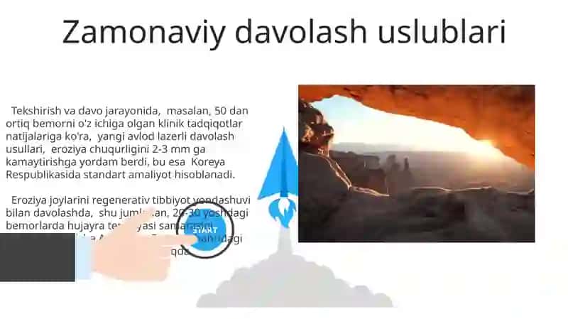 Erroziya Kasalliklari 3