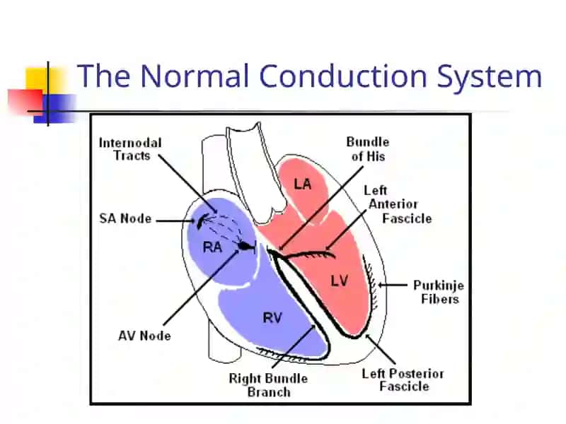 EKG Interpretation 3