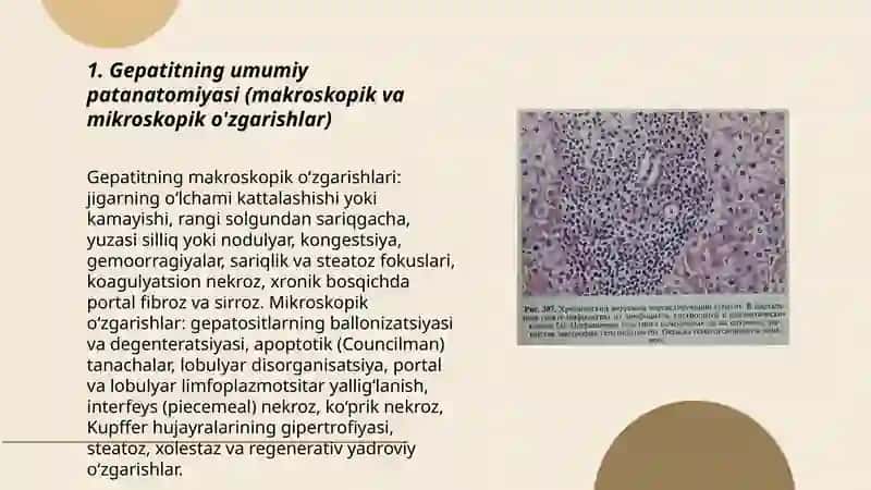 Gepatit, virusli gepatit patanatomiyasi 3