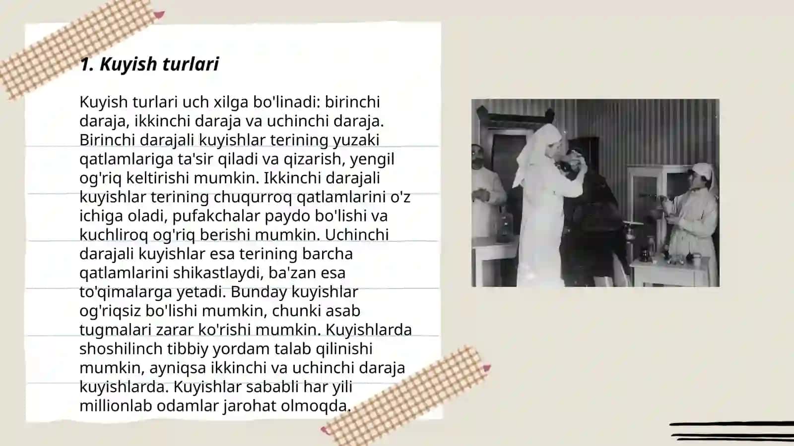 Kuyish.Turlari, Darajalari va Tasniflanishi 3