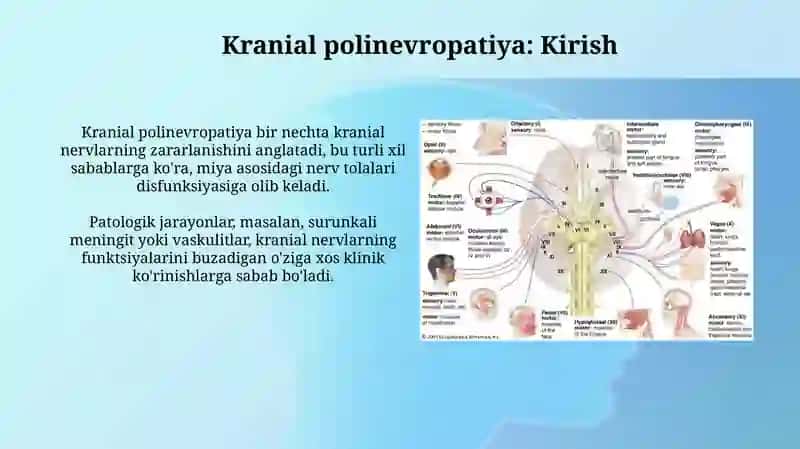 Kranial polinevropatiya 3