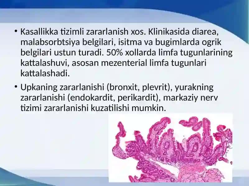 Uippl kasalligi (ichak distrofiyasi) 3
