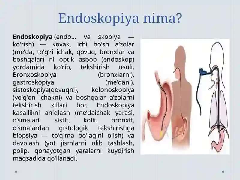 Endoskopik Usullar Tibbiyot 3
