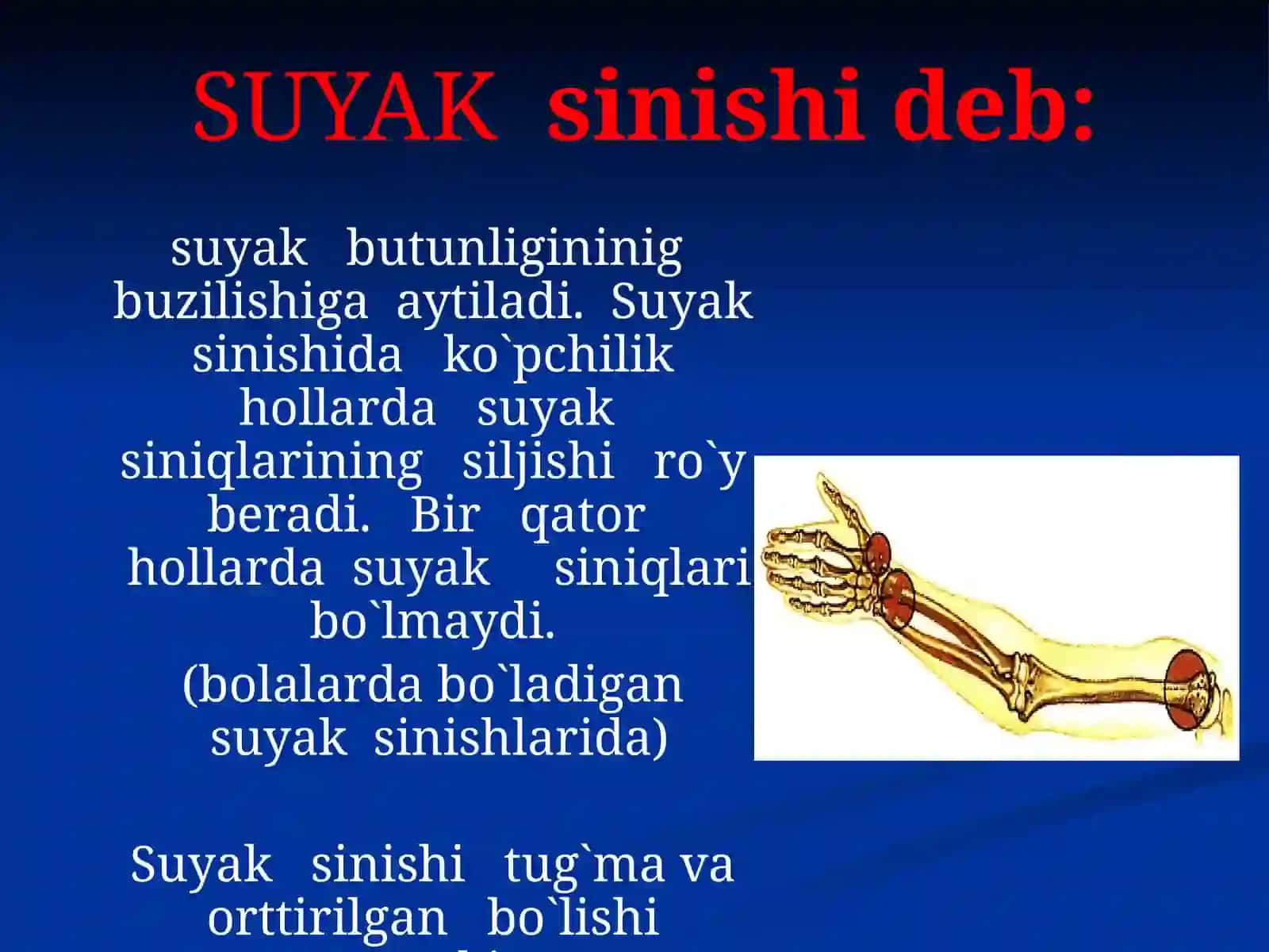 TAYANCH HARAKAT APARATINING MEXANI SHIKASTLANISHI 3