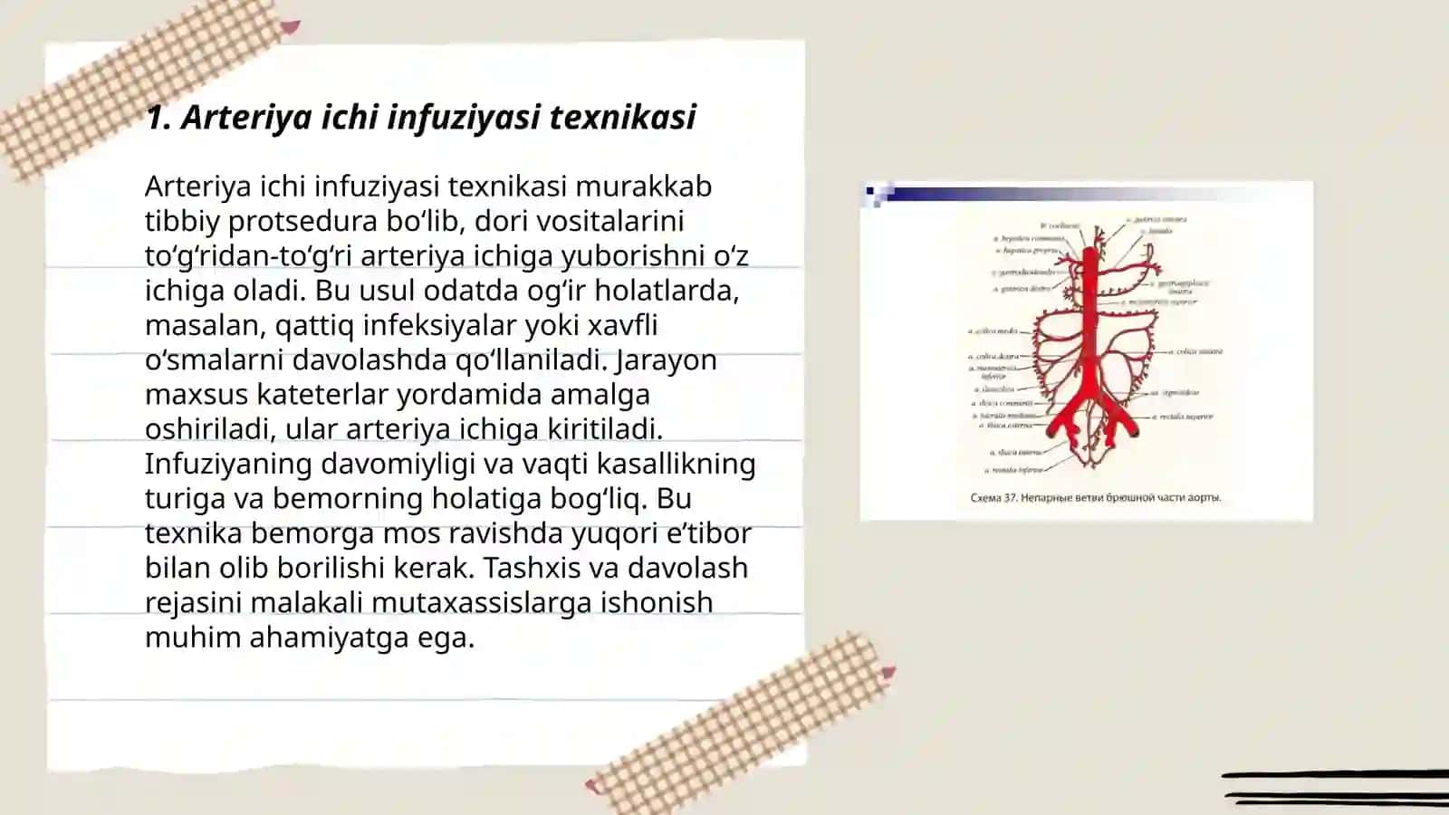 Arteriya ichi infuziyasi 3