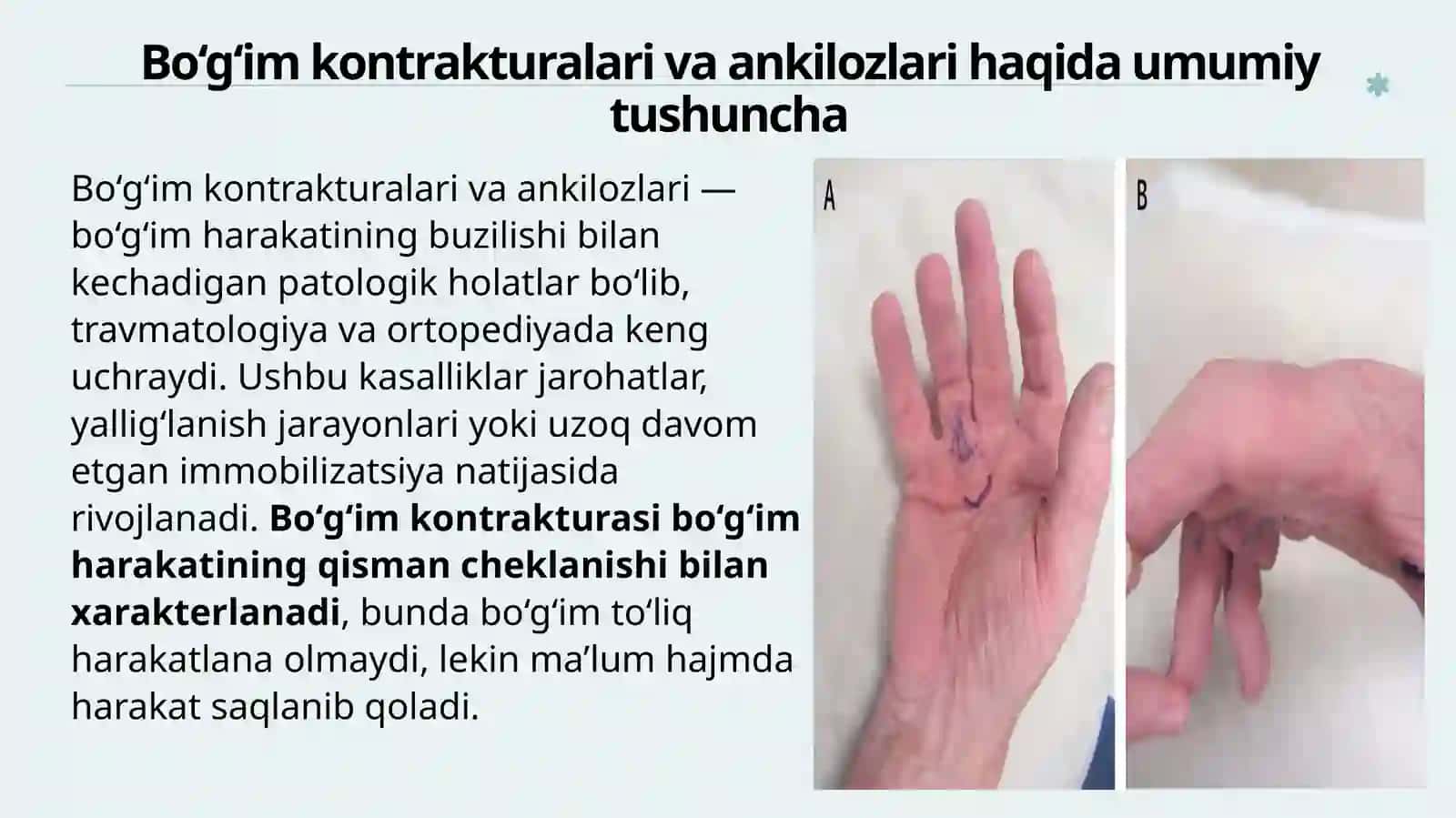 Bo‘g‘imlar kontrakturalari va ankilozlari 3
