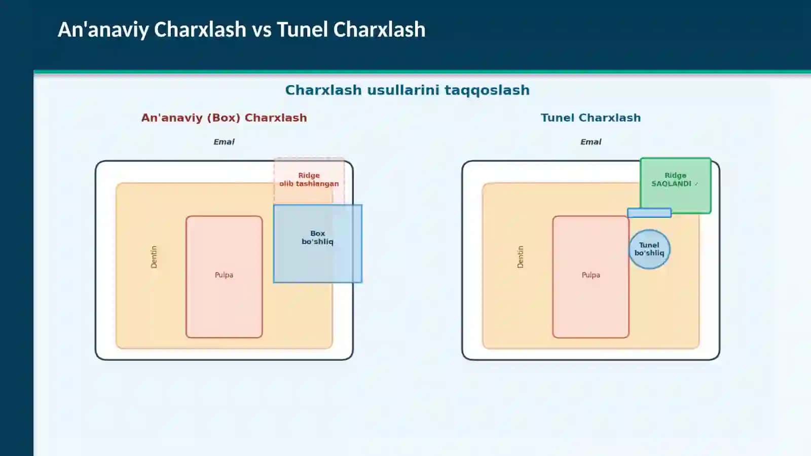 TUNEL CHARXLASH USULI (Tunnel Preparation) 3