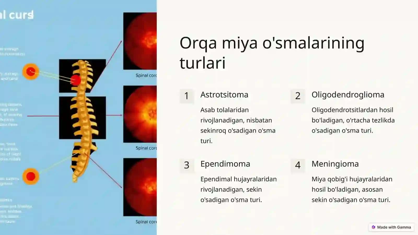 Orqa miya o'smalari va turlari 3