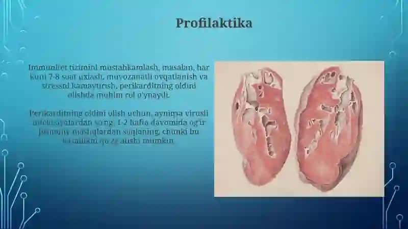 Perikarditlar 3