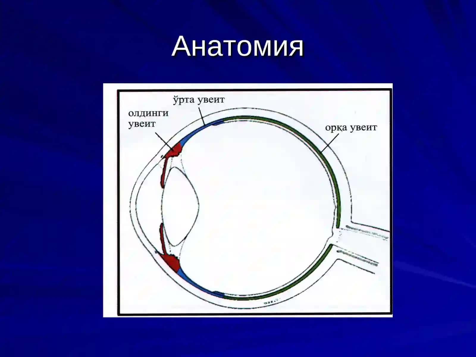 УВЕИТ 3