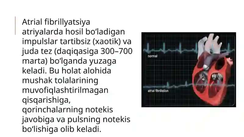 Atrial fibrillyatsiya 3