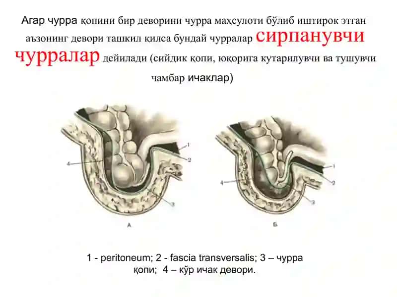 Чурра элементлари 3