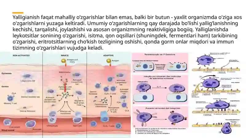 Yallig’lanishning tizimli tasirlari 3