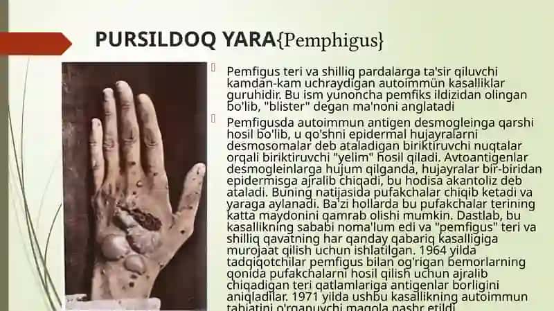 Dermatozlar va po'rsildi kasalliklari 3