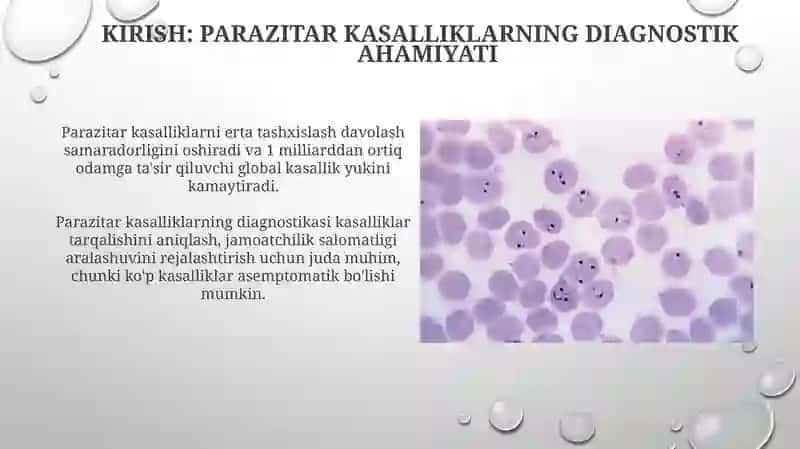 Parazitarkasalliklarningdiagnostikusullari 3