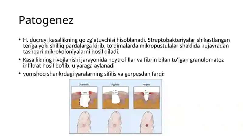 Dermatovenerologiya fanidan Mustaqil ish 3
