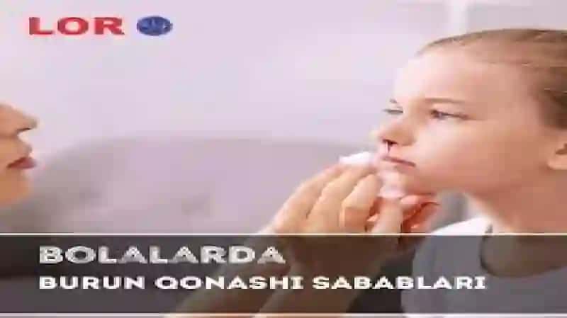 Bolalarda burun qonashi 3