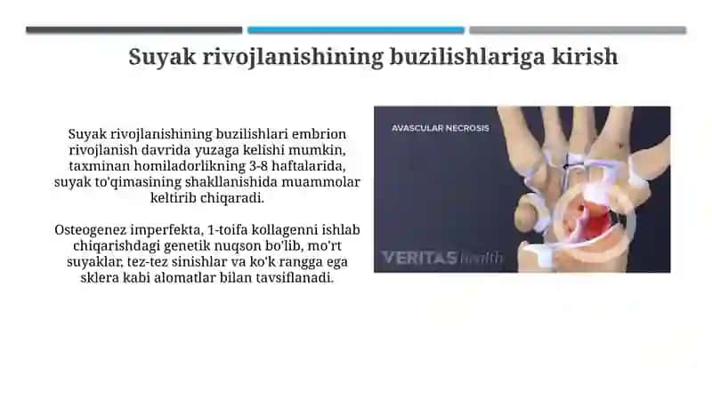 Suyaklarni rivojlanishini buzilishlari 3