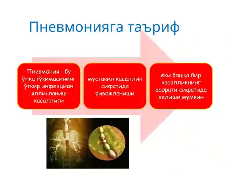 Чакалоклар пневмонияси 3