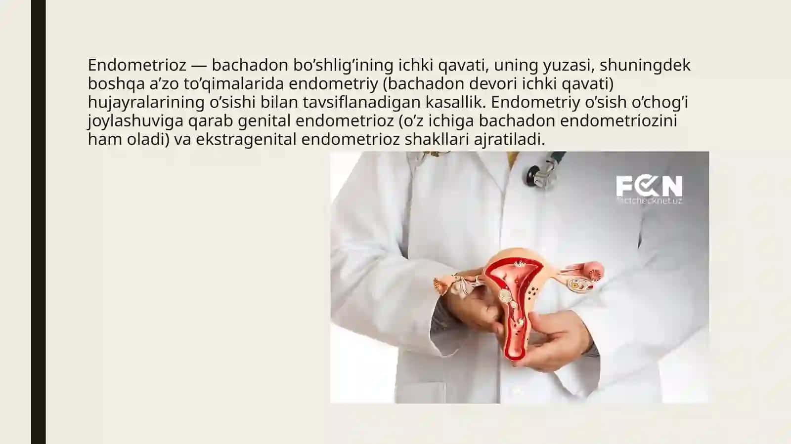 ENDOMETRIOZ 3