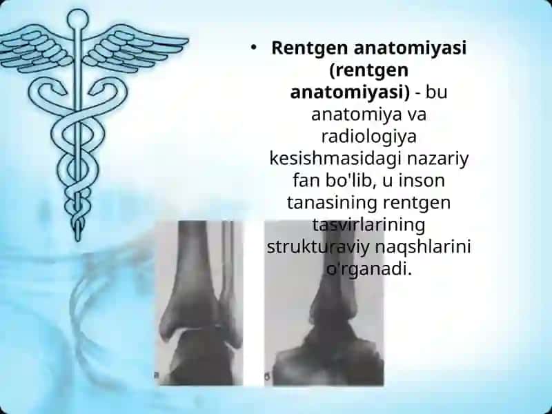 Oyoq panjasi suyaklarining rentgeno anatomiyasi 3