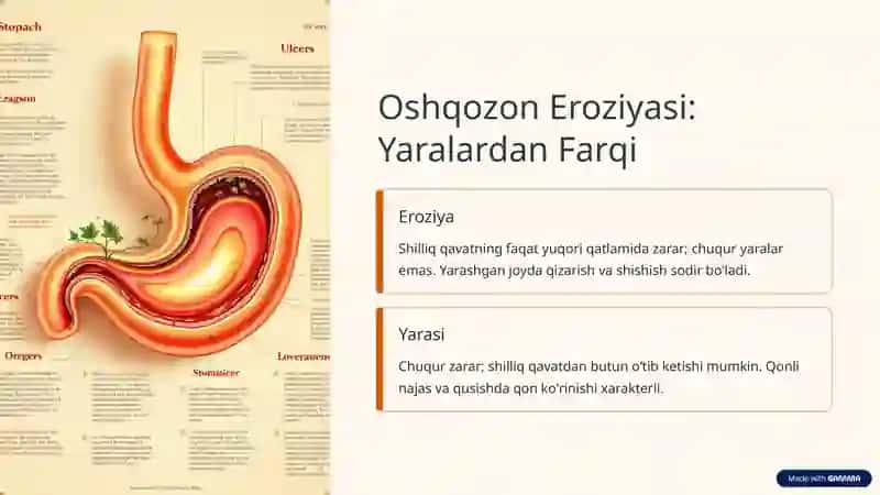 Oʻtkir Oshqozon Yaralari va Eroziyalari 3