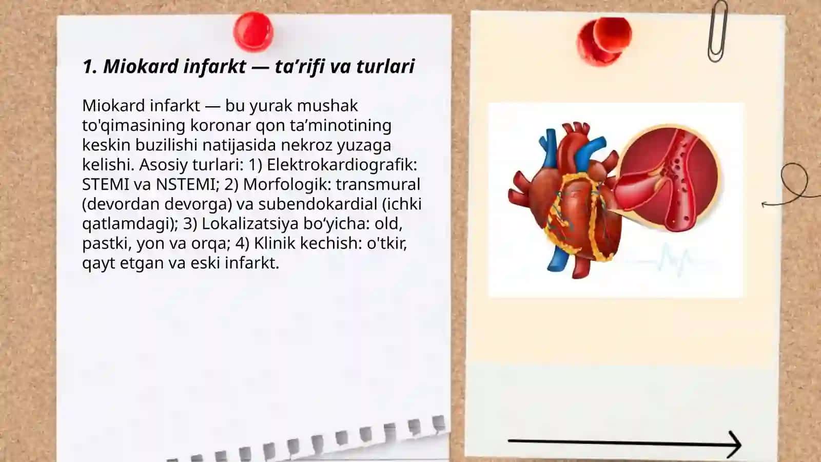 Miokard infarkt kasalligi haqida 3