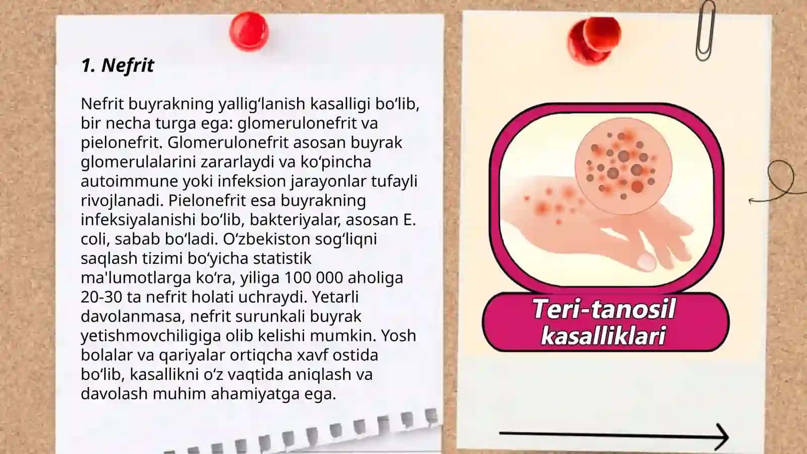 Siydik - tanosil tizimining kasalliklari 3