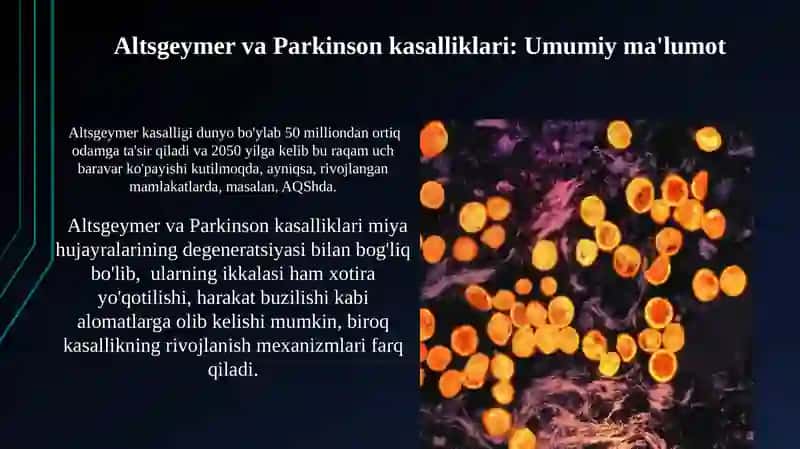 Altsgeymer va Parkinson kasalliklari 3