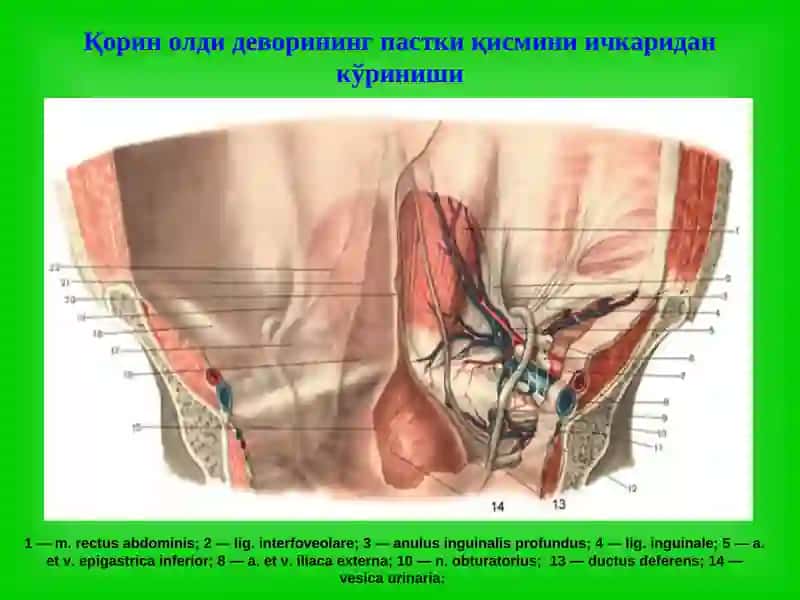Чов, сон, киндик ва қорин оқ чизиғи чурралари 3