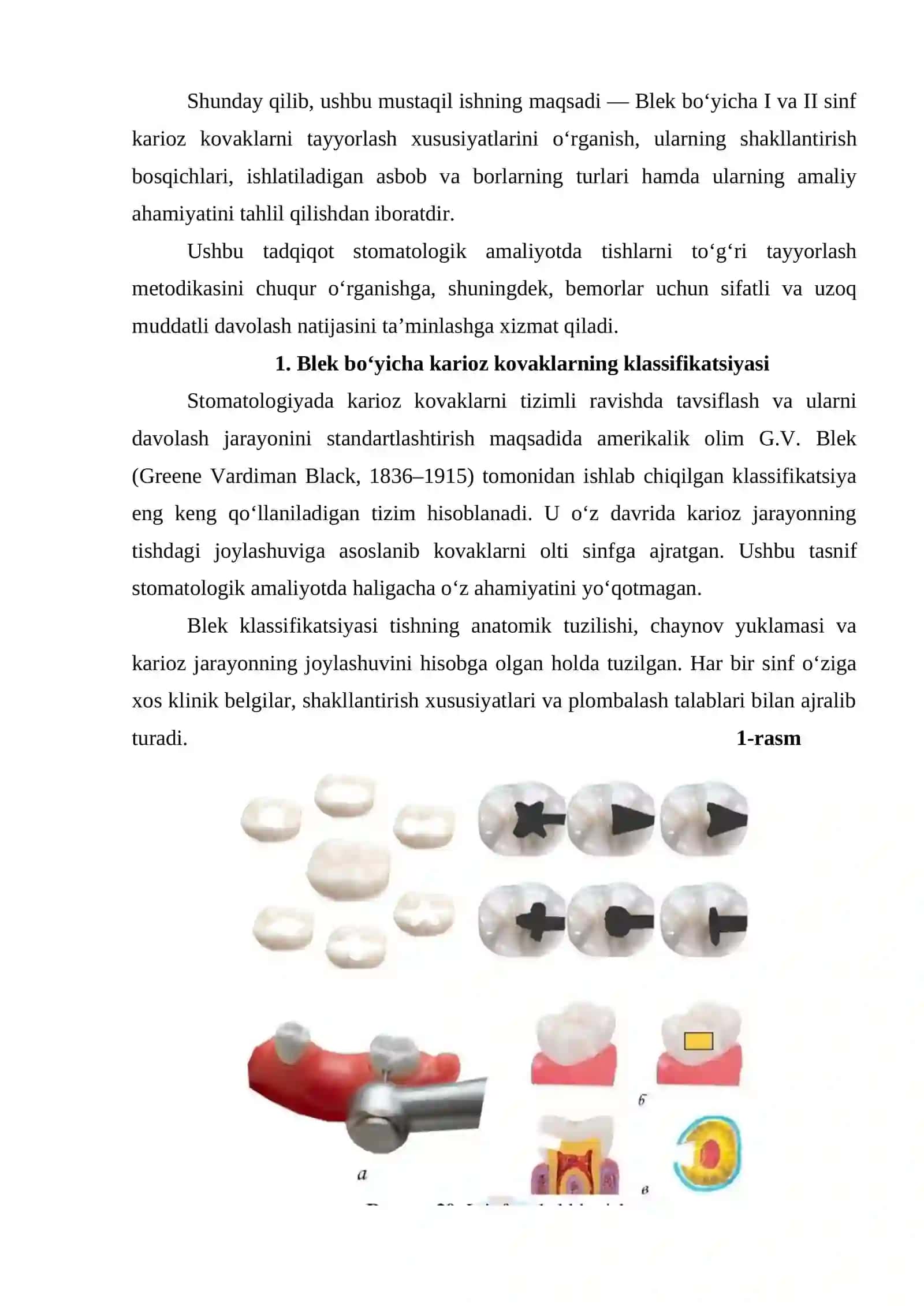 Blek bo‘yicha I va II sinflarni tayyorlash xususiyatlari 3