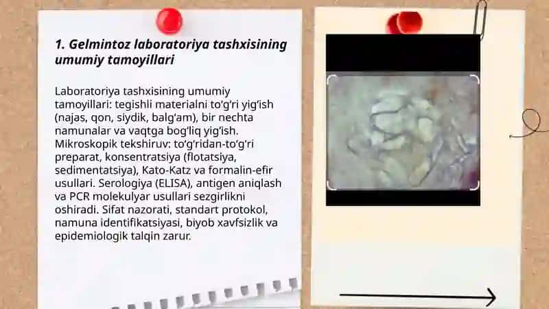 Gelmintoz labarator tashxisi 3