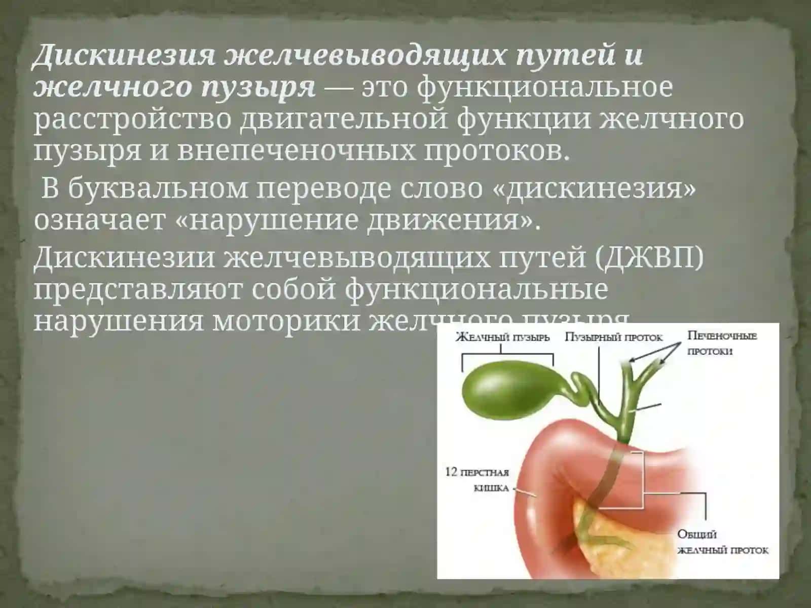 Дискинезия желчевыводящих путей у детей 3