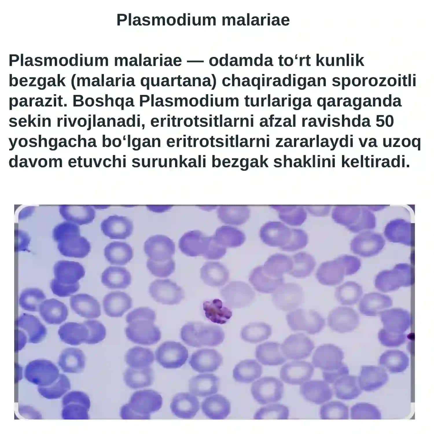 Plasmodium malariae 3
