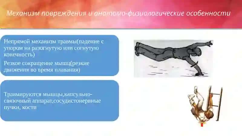 Травматический вывихудетей 3