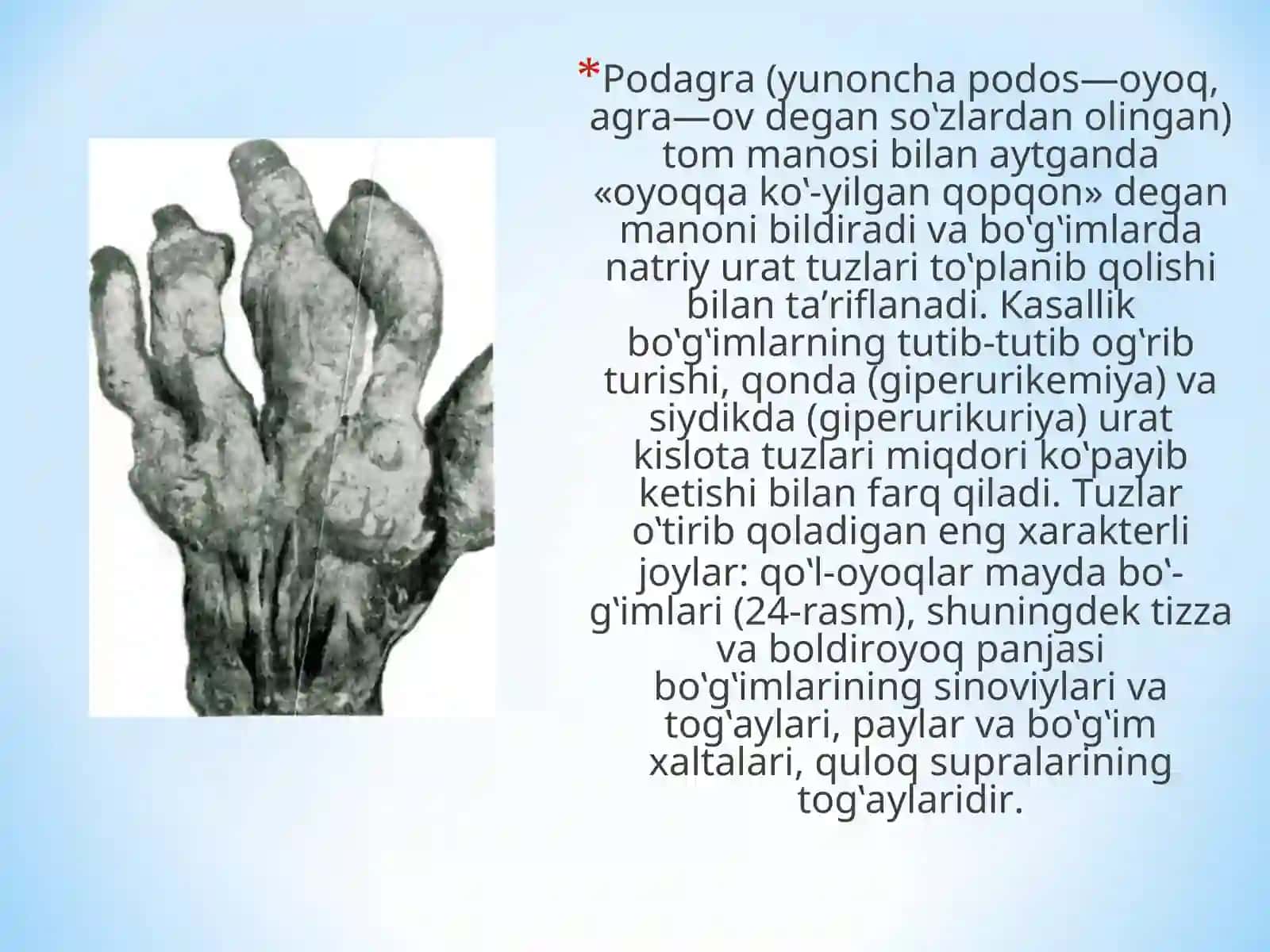 Tosh kasalliklarining kimyoviy asoslari 3