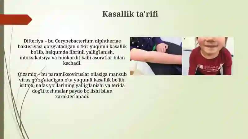 Difteriya va Qizamiq kasalliklari 3