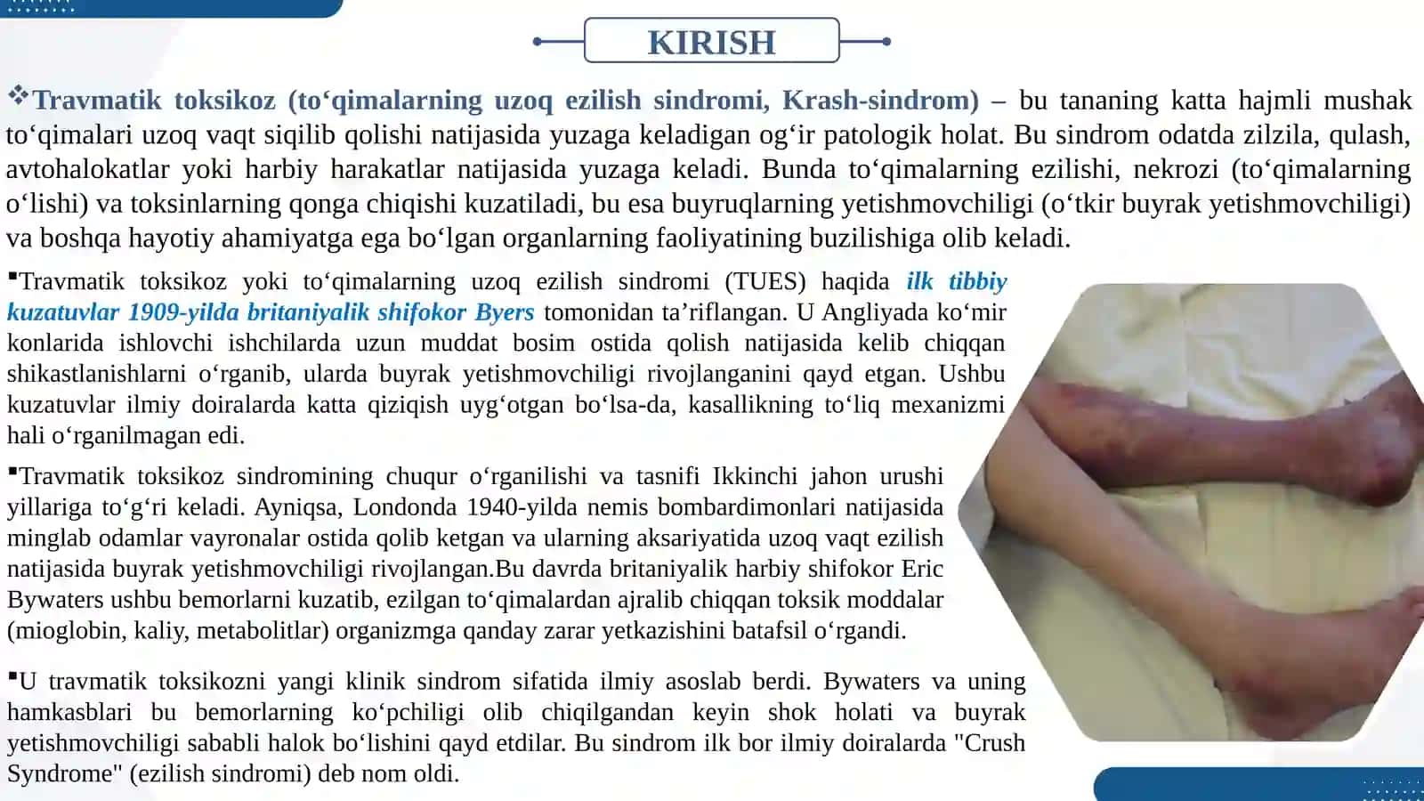 Travmatik toksikoz (to‘qimalarning uzoq ezilish sindromi, Krash-sindrom) 3