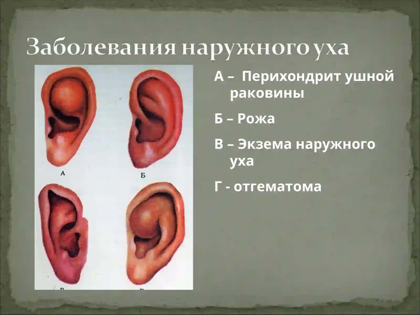 касалликларни этиопатогенези 3