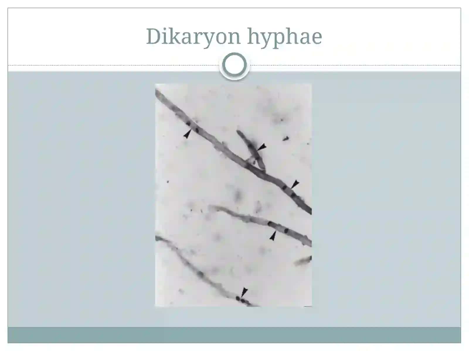 Ascomycetes 3