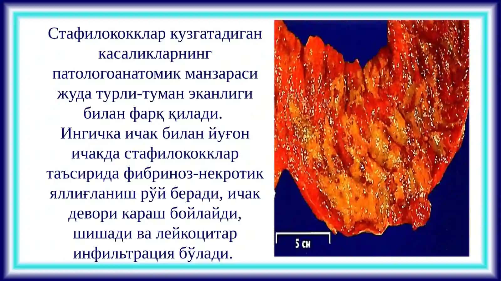 ПАТОЛОГИК АНАТОМИЯ ВА СУД ТИББИЁТИ 3