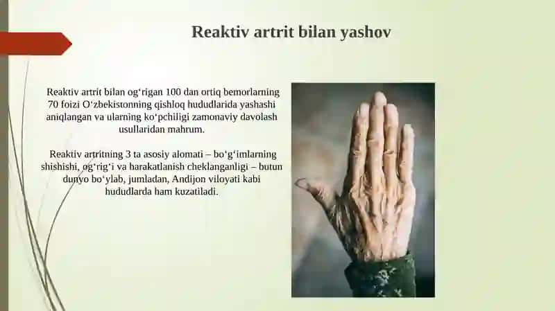 Reaktiv artritlar 3